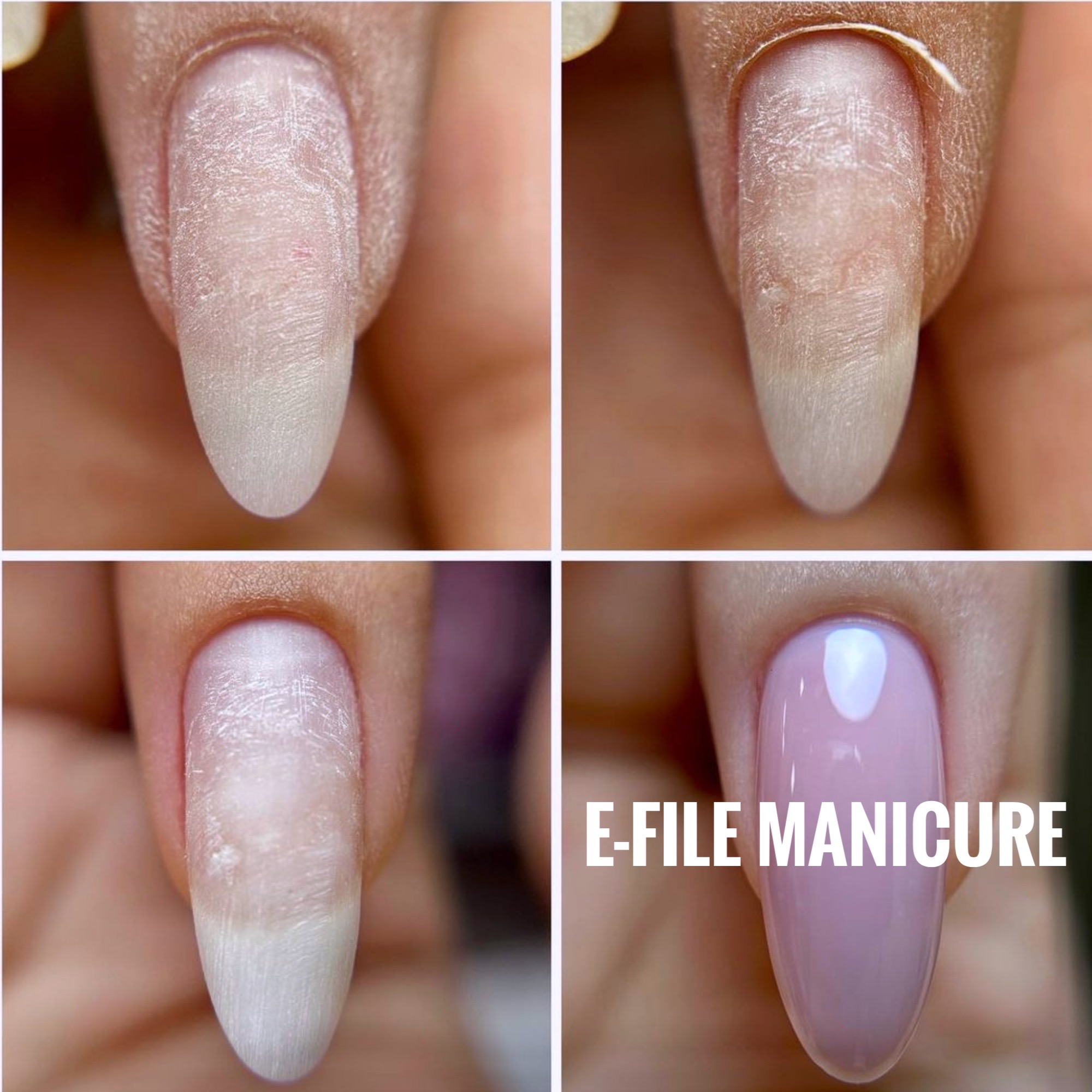 Anatomy of the Nail Safety & Sterilization "Russian manicure" technic Gel Application (2000 × 2000 px) - 1 Students Emi School Manicure Courses Toronto Canada